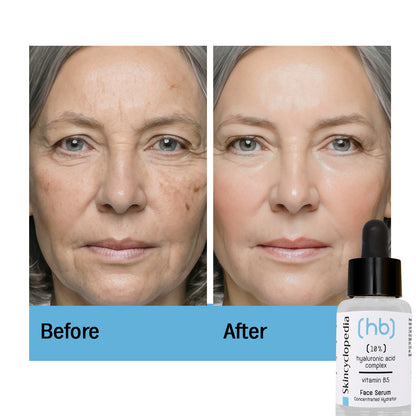 Face Treatment: Hyaluronic Acid + Vitamin B5 + Hydrating Complex 20%