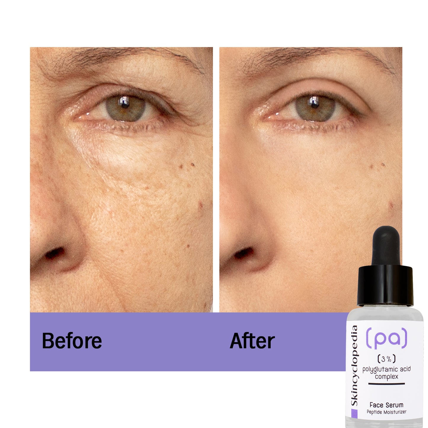 Facial Treatment: Polyglutamic & Peptide