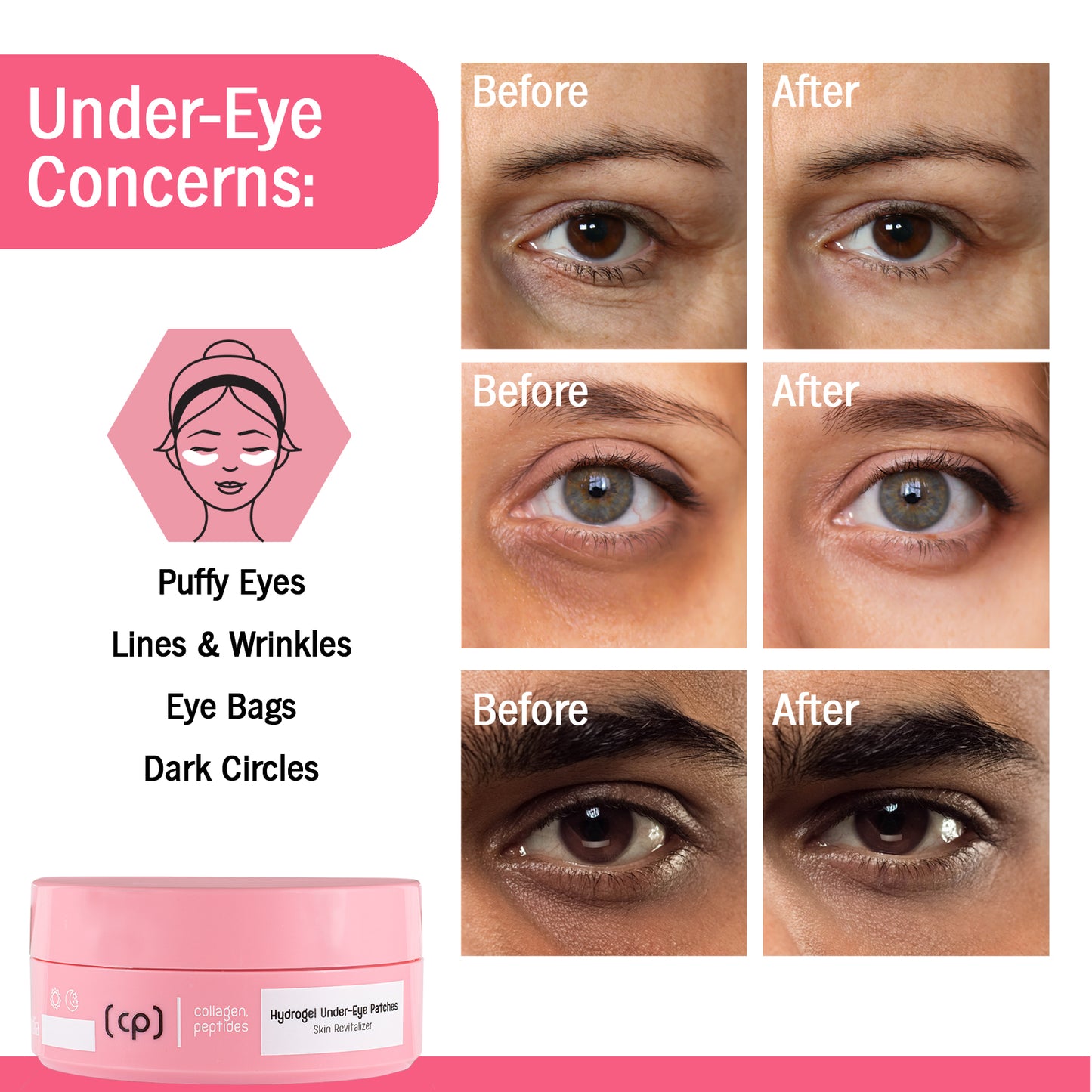 Collagen deeply hydrating under-eye skin to prevent dryness.