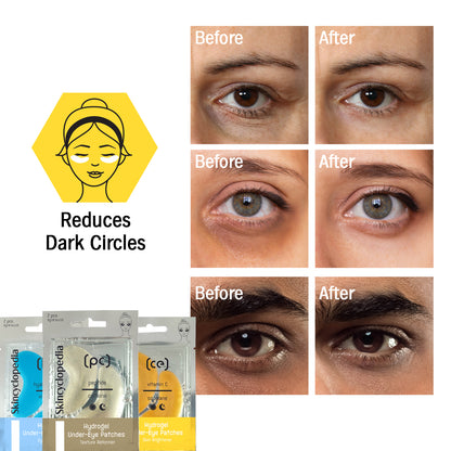 Under-eye patches reducing fine lines and wrinkles